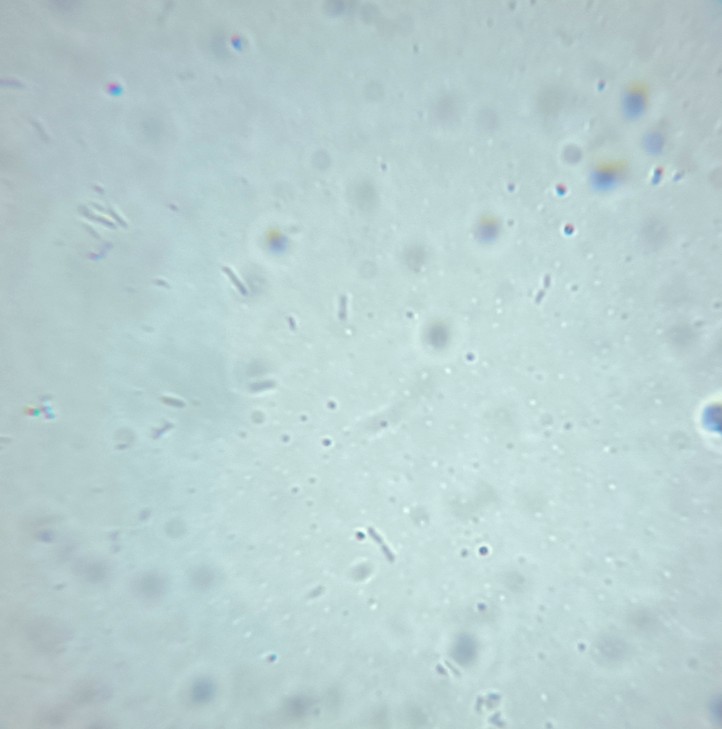 Bacilli o cos''altro?